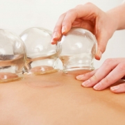 Chinese Cupping & Dry Needling